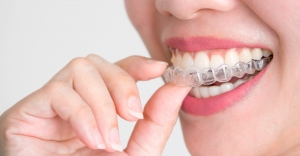 How Are Dental Braces Beneficial for Your Teeth Alignments?